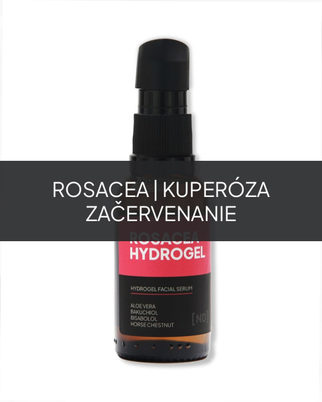 NAMYDERM - Rosacea Hydrogel – prírodný gél na rosaceu, kuperózu a začervenanie pleti –30ml 1