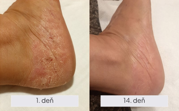NAMYDERM - Dermal Sensitive – prírodný dermálny krém pre citlivú a reaktívnu pokožku – 50 2