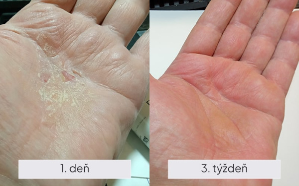 NAMYDERM - Dermal R – prírodný dermálny krém na popraskanú a extrémne suchú pokožku– 50 ml 1