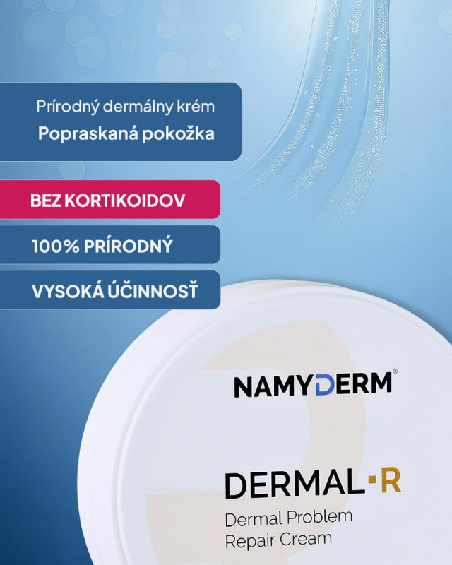 NAMYDERM - Dermal R – prírodný dermálny krém na popraskanú a extrémne suchú pokožku– 50 ml