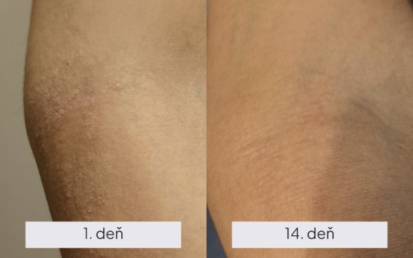 NAMYDERM - Dermal L -prírodné dermálne mlieko pre suchú, svrbiacu, podráždenú pokožku 50ml 2
