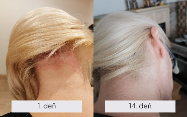 NAMYDERM - Dermal L -prírodné dermálne mlieko pre suchú, svrbiacu, podráždenú pokožku 50ml 1
