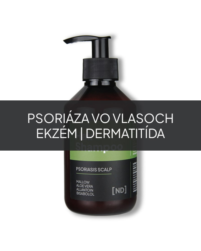 NAMYDERM - Prírodný šampón na psoriázu vo vlasoch – Psoriasis Scalp - 250 ml 1
